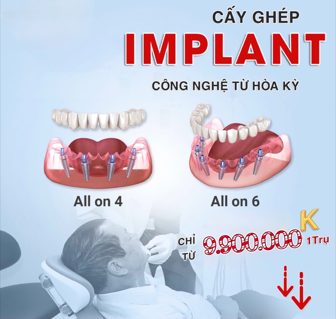 Cấy Ghép Implant Tết Nguyên Đán Ất Tỵ