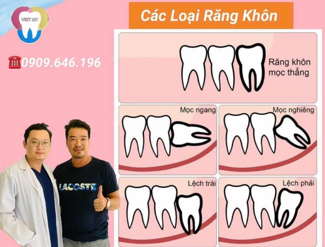 “Nhổ Răng Khôn Nhanh - An Toàn- Không Đau “