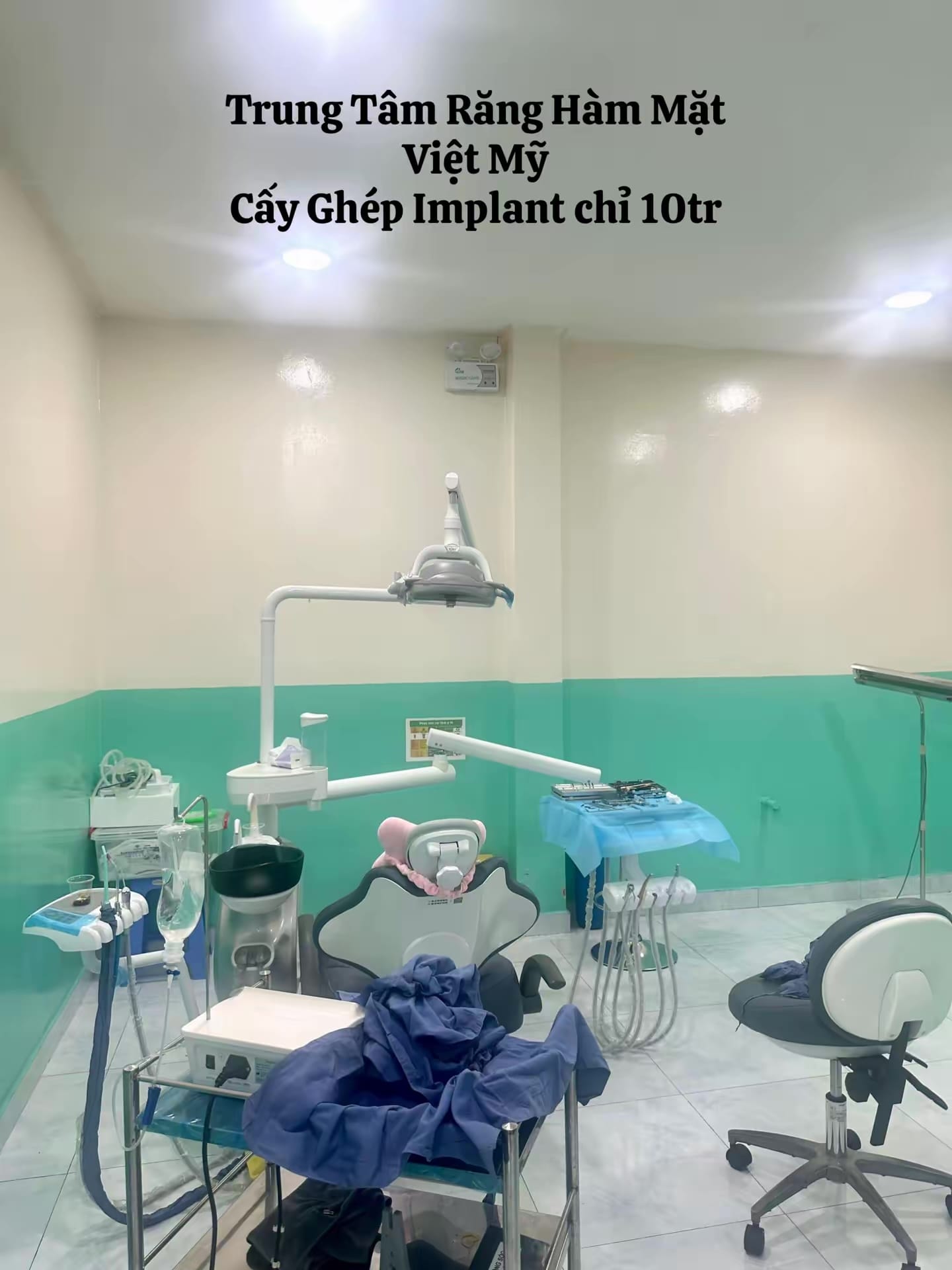 Trồng Răng Implant và Những Điều Bạn Cần Biết ?