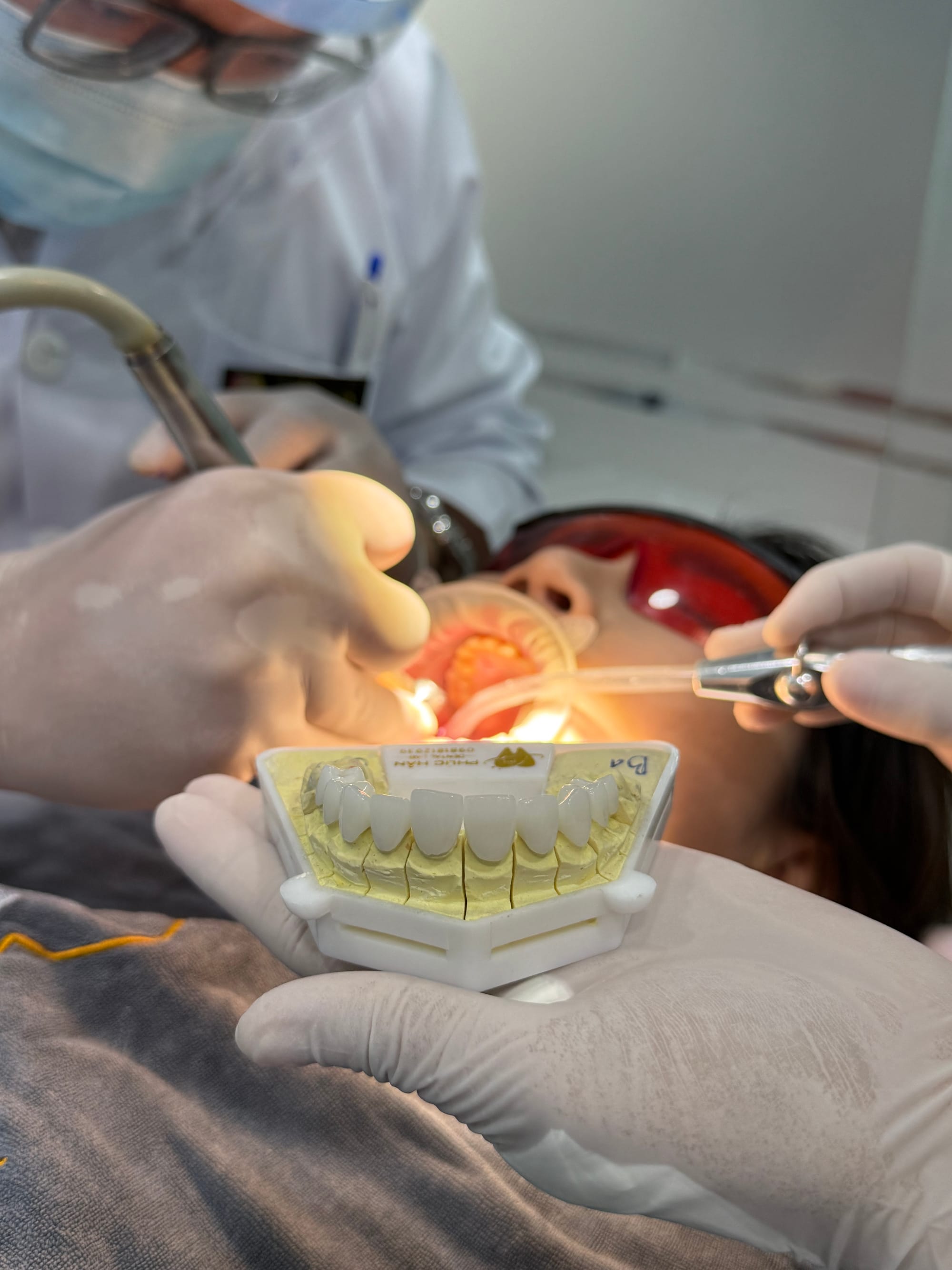Bọc Răng Sứ Và Những Điều Bạn Cần Biết Khi Làm Răng Tại Trung Tâm Răng Hàm Mặt Việt Mỹ
