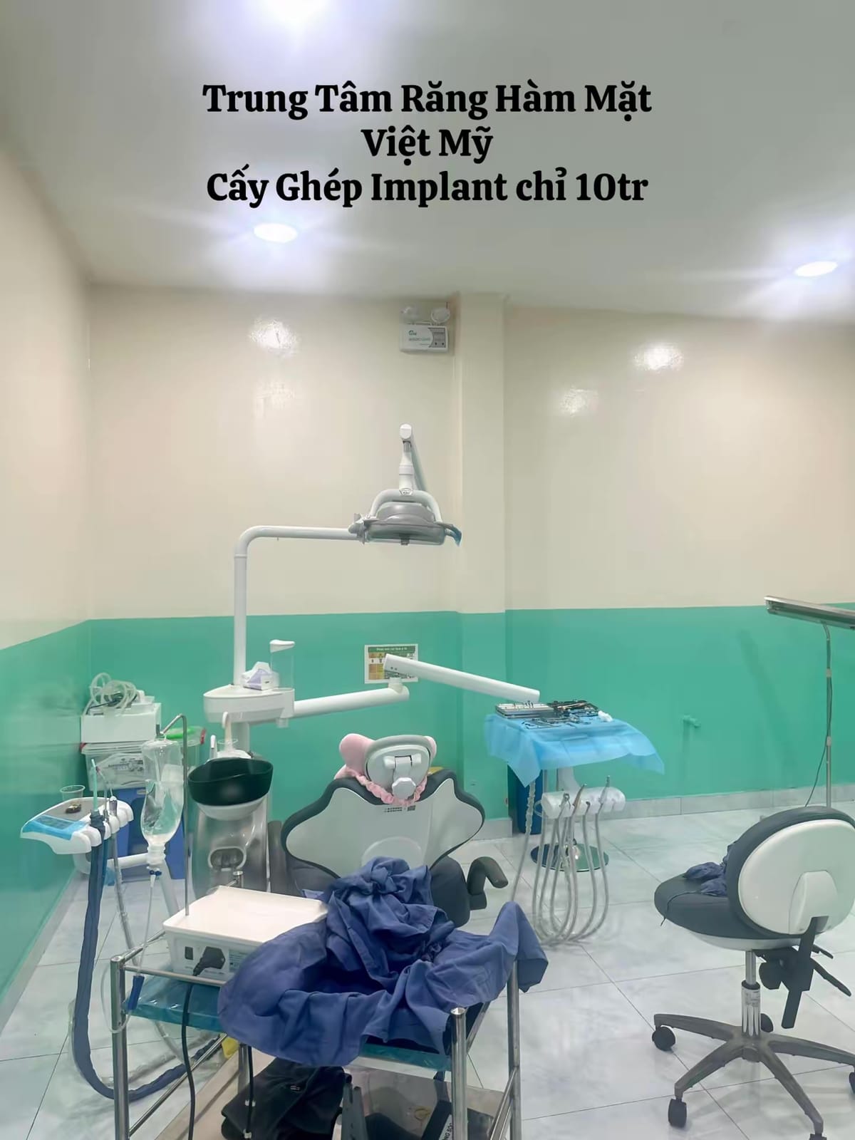 Trồng Răng Implant và Những Điều Bạn Cần Biết ?